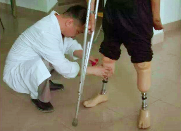 双腿假肢-舒捷假肢厂家.jpg