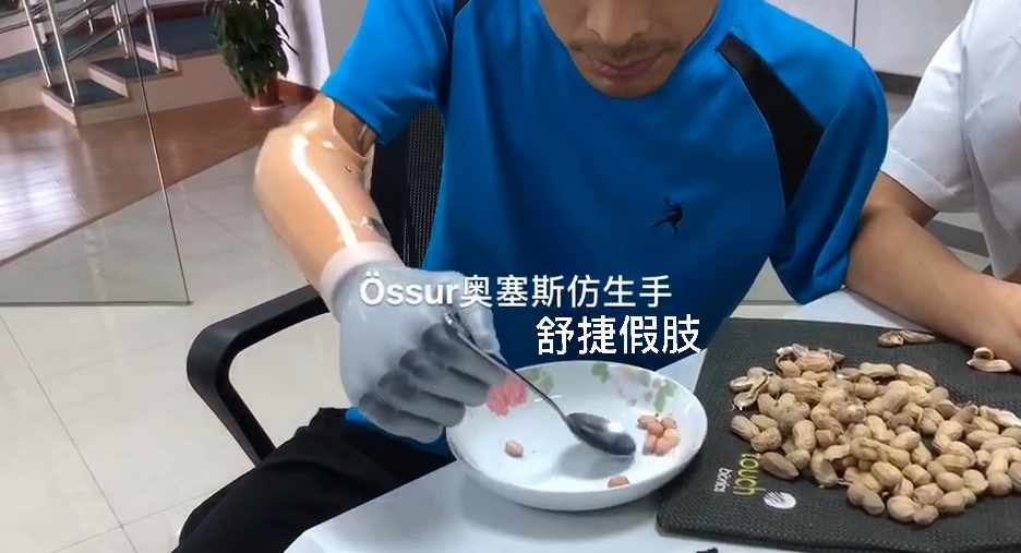 假肢价格