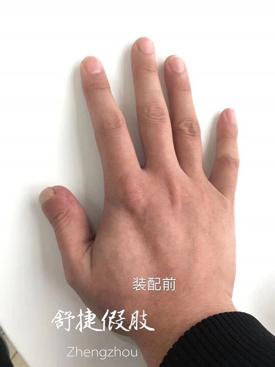 硅胶假手指